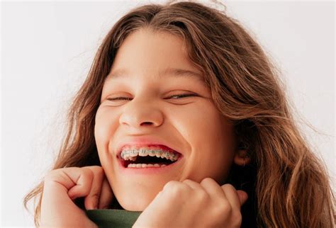 Braces in Roseville - Roseville Orthodontics