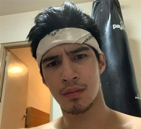 ‘Don’t breed’: Albie Casiño expresses dismay on gov’t, blames DDS - The ...