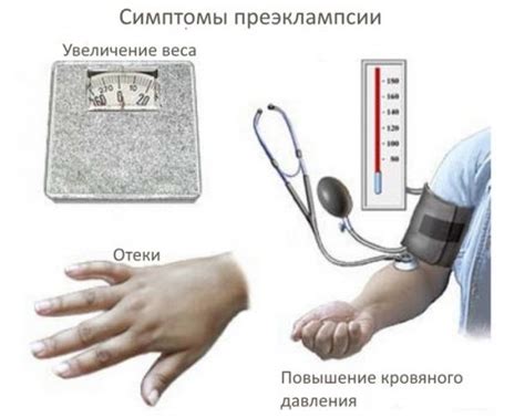 Преэклампсия: причины, симптомы, степени и лечение