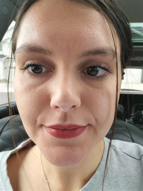 textured skin on face 10