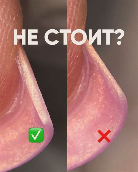 МАНИКЮР ГЕЛЬ-ЛАК НАРАЩИВАНИЕ НОГТЕЙ | НЕ СТОИТ👎🏻 Все чаще и чаще я ...