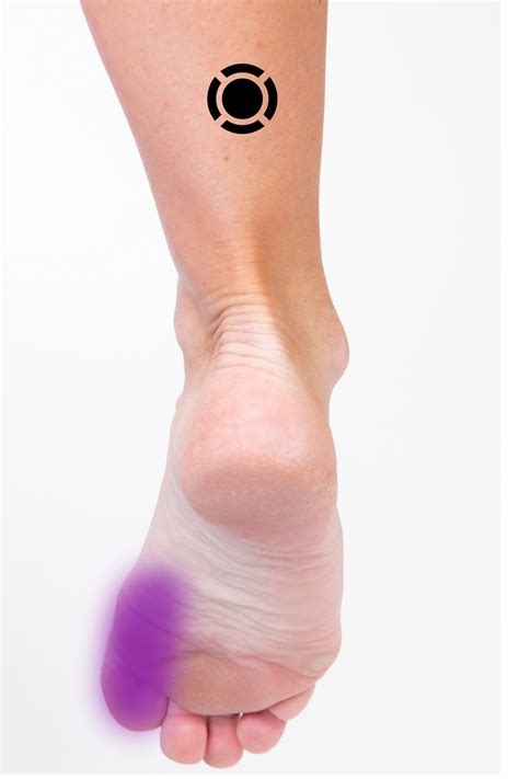 Flexor Hallucis Longus Summary – Komizo Diagnostics