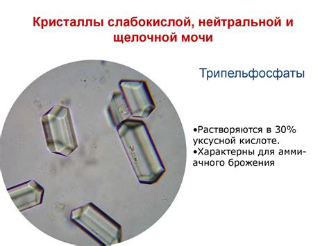 Микроскопия осадков мочи - презентация онлайн