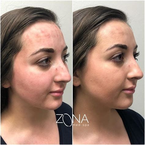 Пин на доске Before & After Pictures