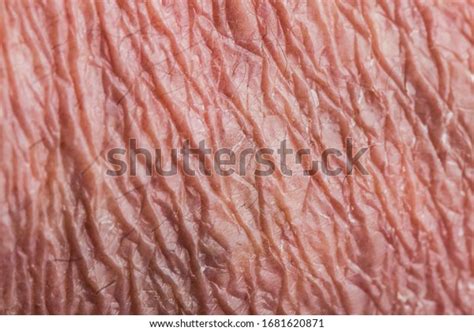 wrinkly skin images stock  vectors shutterstock
