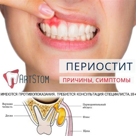 Pin on info patient