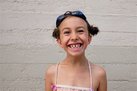 How to Fix Gap Teeth: Treatment Options and Maintenance Tips