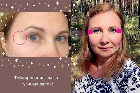 Тейпирование глаз от морщин и гусиных лапок! - Леди Молодость