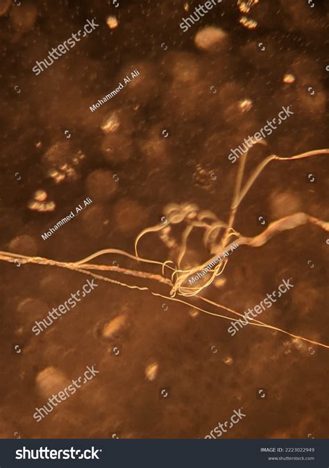 Photo Spider Silk Under Microscope Stock Photo 2223022949 | Shutterstock