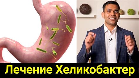 Лечение Хеликобактер домашними средствами / Доктор Вивек - YouTube