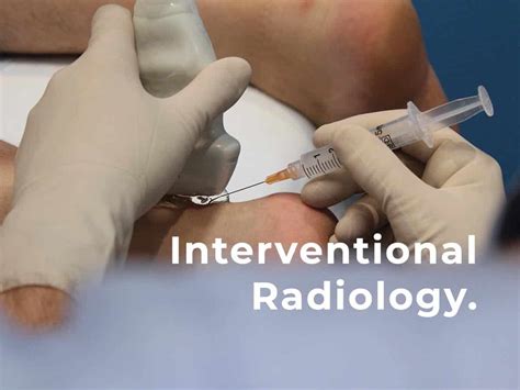 Ultrasound Guided Prp Injection Knee Joint Chennai In - vrogue.co