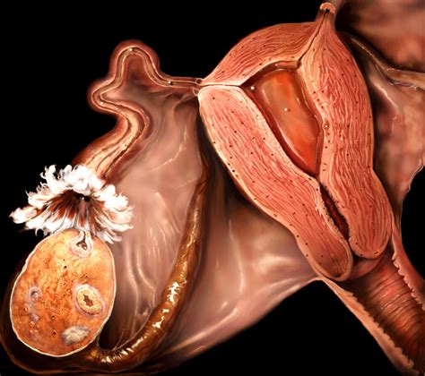 Reproductive Organs Ovaries And Uterus In The Male Bo - vrogue.co