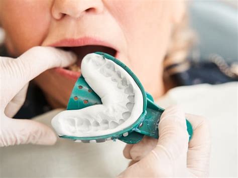 digital  physical dental impressions pros cons
