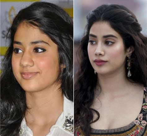 Sridevi Nose Job