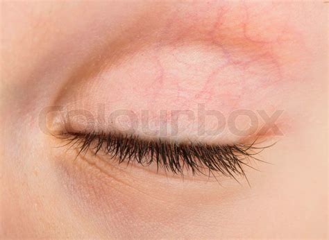 Human eye closed | Stock image | Colourbox