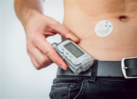Smart Infusion Pump Problems Targeted By New ISMP Guidelines For ...