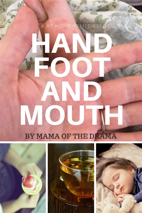 Natural remedy for hand foot mouth disease – Artofit