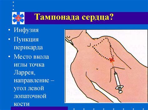 Неотложная помощь при автодорожной травме - online presentation