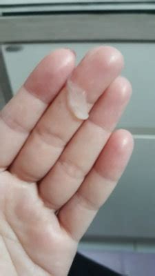 Muco Branco Sem Cheiro - 3 dias pra M nn vir... muco branco aquoso com grumos ... | BabyCenter