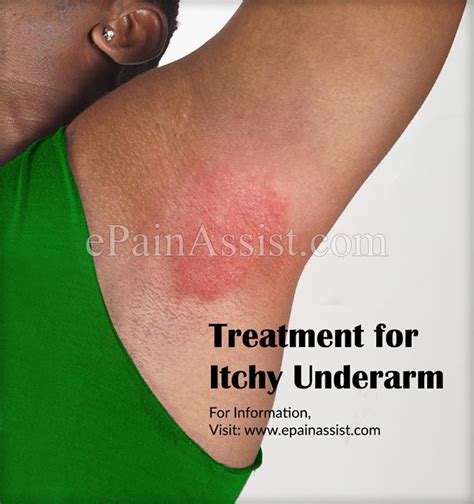 Sweat Spot Sos: 5 Proven Ways To Eliminate Underarm Blemishes