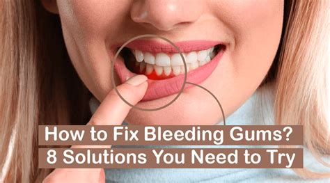 how to fix bleeding gums