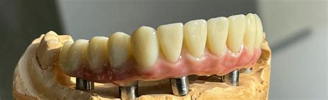 What you can expect from Sofia Implant Centre. Materials, service ...