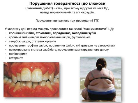 Цукровий діабет - презентация онлайн