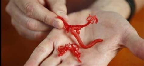 Artificial blood vessels created with a 3D bio-printer tecnology ...