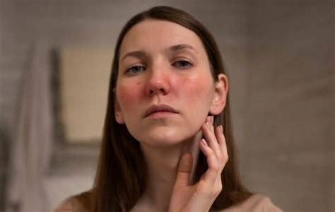 peeling mengenal manfaat  efek sampingnya