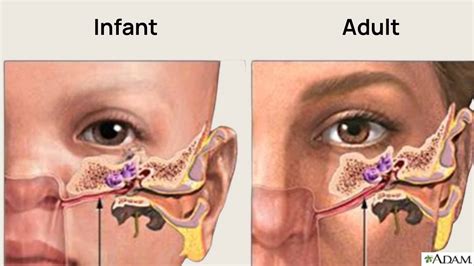 Crackling In The Ear: Causes and At Home Treatments
