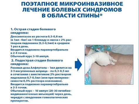 Диагностика и лечение болевых синдромов - презентация онлайн