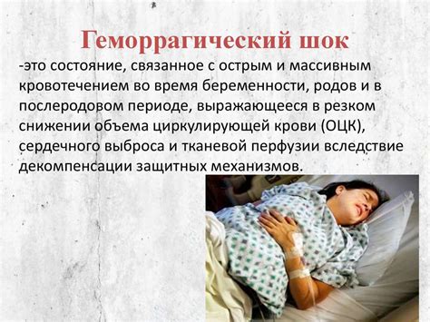 Геморрагический шок в акушерстве - презентация онлайн