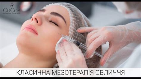 Классическая мезотерапия лица - YouTube