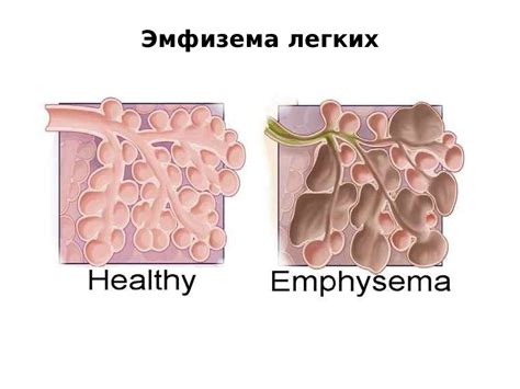 Анатомо-физиологические и психологические особенности лиц пожилого и ...