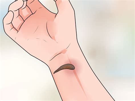 3 Simple Ways to Make a Bruise Go Away Faster - wikiHow