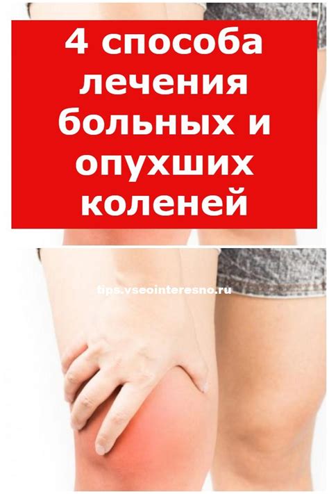 4 способа лечения больных и опухших коленей - tips