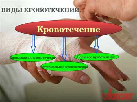 Первая помощь при кровотечениях