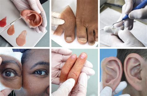 silicone prosthesis highly detailed milwaukee wi life