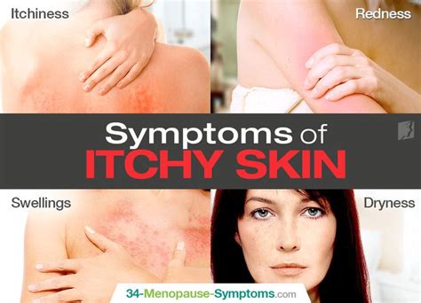 symptoms  itchy skin