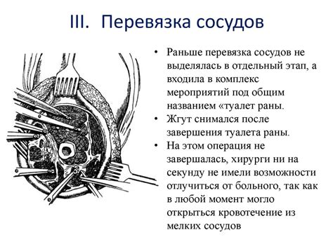 Учение об ампутациях - презентация онлайн
