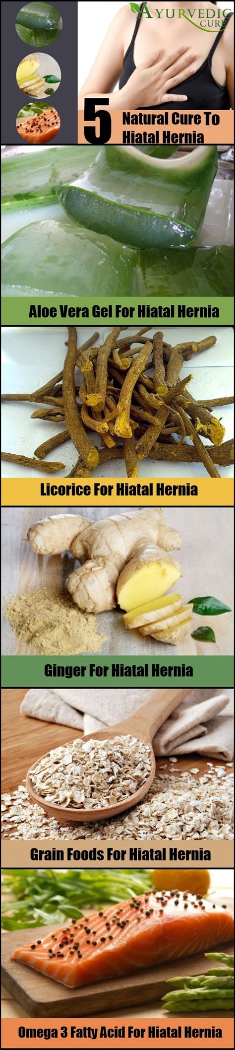 17 Best images about HIATAL HERNIA-HELICOBACTER PILORI on Pinterest ...