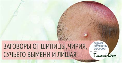 Заговоры от шипицы и чирия