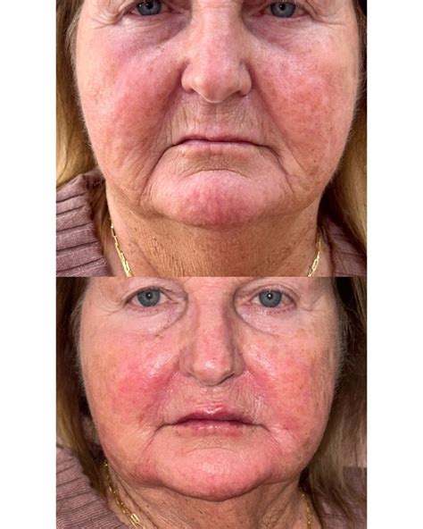 Flawless Beauty Aesthetics... - Flawless Beauty Aesthetics