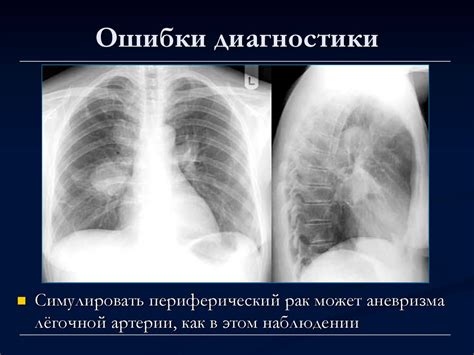 Лучевая диагностика заболеваний органов дыхания - презентация онлайн