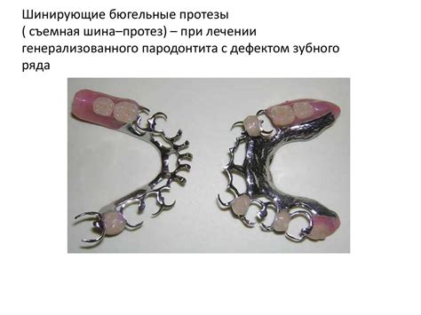 Основные принципы лечения локализованного и генерализованного ...