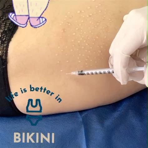El... - EuroDerma - Clínica Dermatológica Antienvejecimiento | Facebook