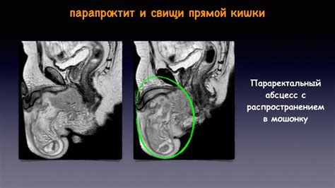 Визуализация прямой кишки и перианальной области