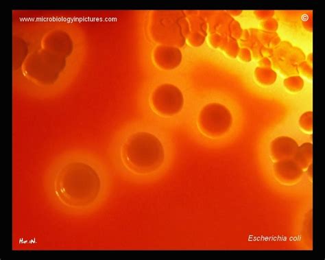 escherichia coli hemolysis  blood  beta hemolytic colonies
