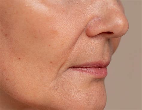 Bigode Chinês: o que é, como surge e como suavizar – Riô SkinLab