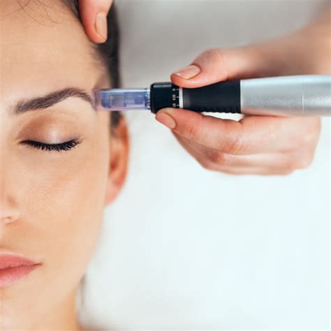 Dermapen Microneedling Μεσοθεραπεία Προσώπου